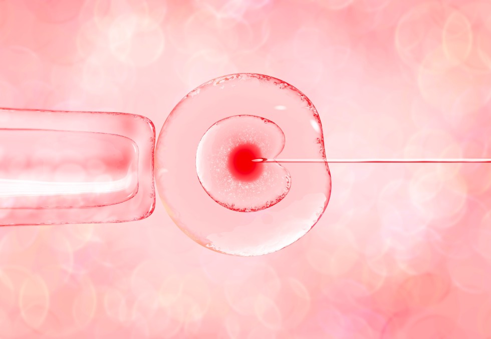 infertilité-ovocyte