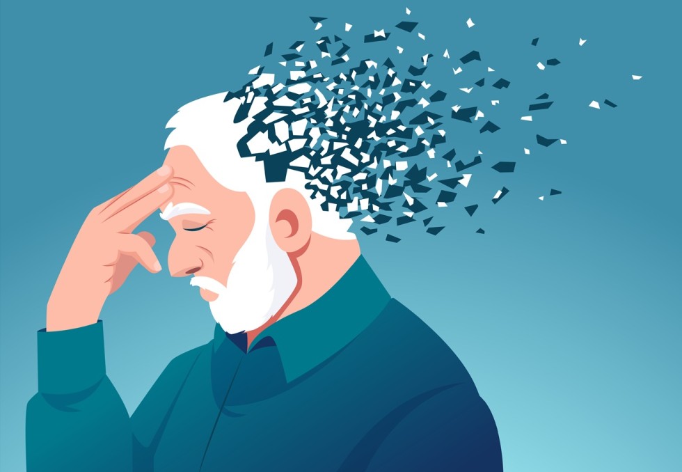 alzheimer