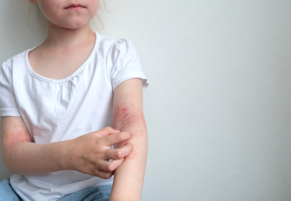 Dermatologie