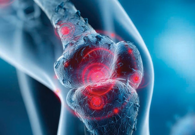 Biothérapie en rhumatologie : quel suivi en médecine générale ?