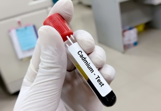 cadmium test