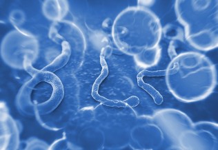 Ebola
