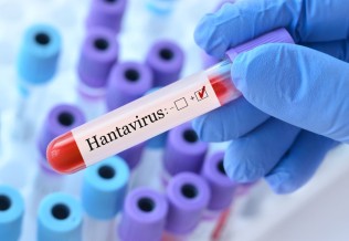 hantavirus