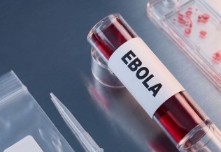 Ebola