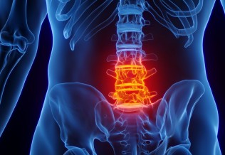Spondyloarthrite ankylosante