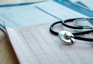 ecg