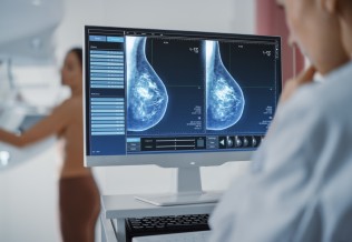 mammographie