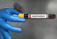 hantavirus