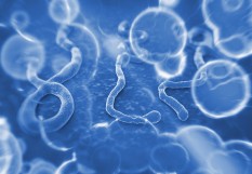 Ebola