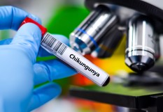 Chikungunya 
