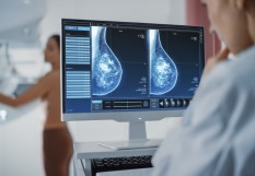mammographie