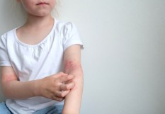 Dermatologie